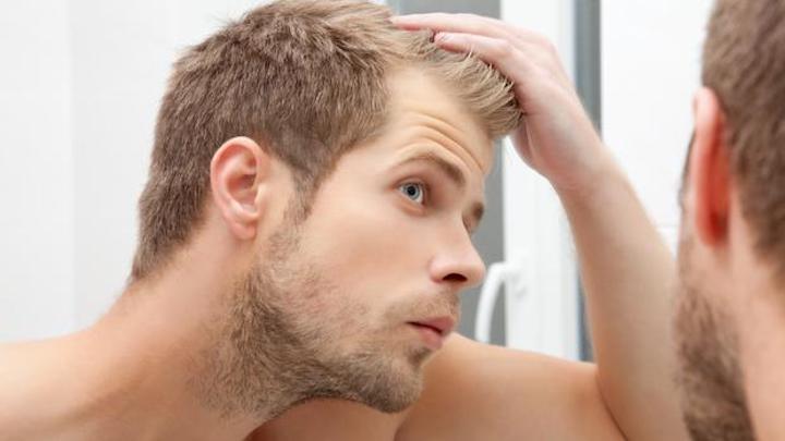 جلوگیری از ریزش مو با ژل رویال